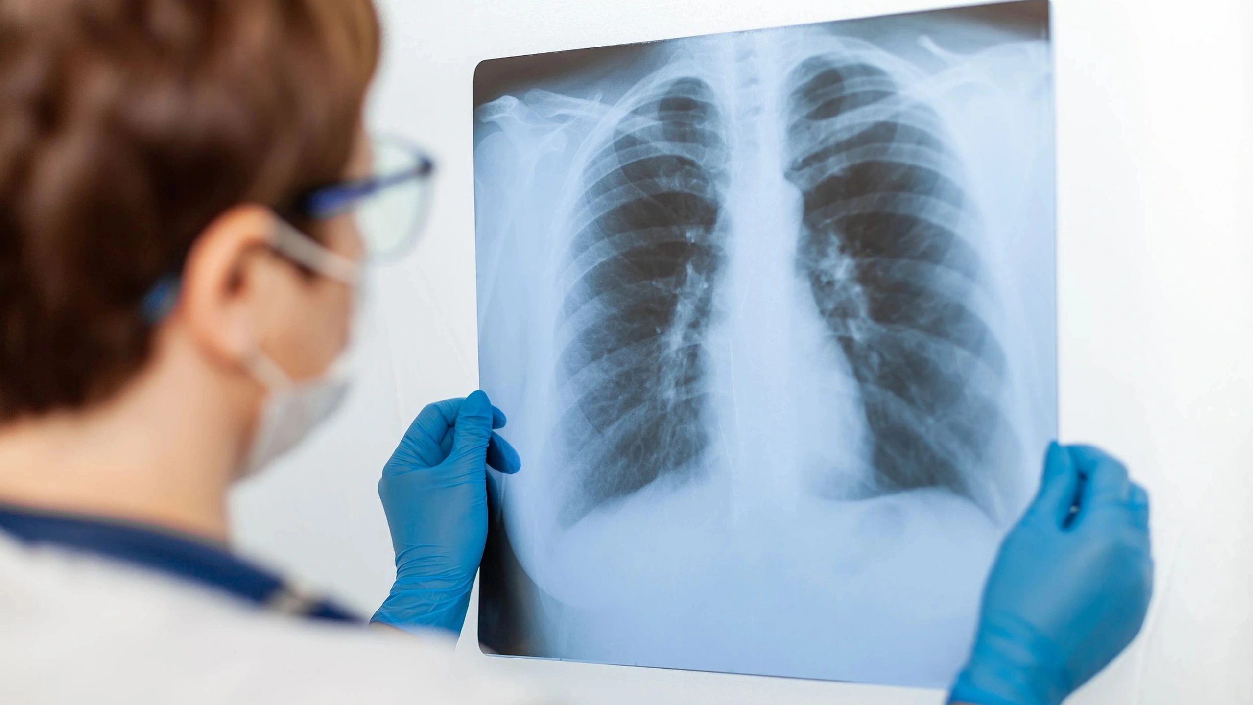 Онколог Нефёдов: на патологии лёгких могут указывать многие симптомы